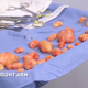 Illustration for article titled Dr. Pimple Popper Removes 68 Lipomas from One Person in Season 2 Premiere
